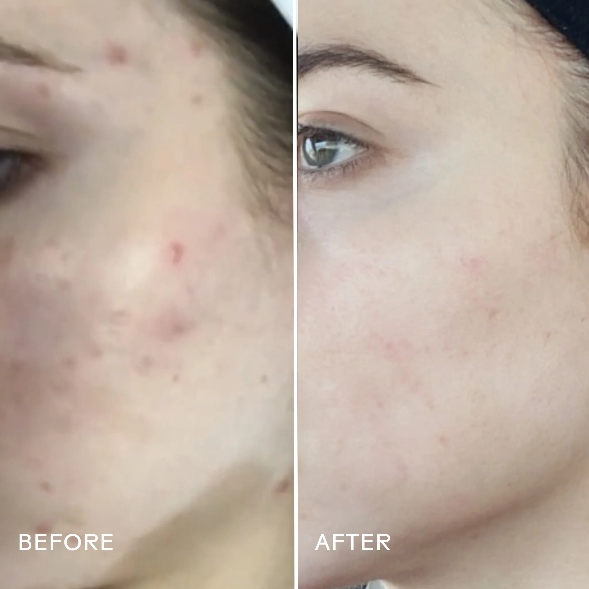 a tinted moisturizer,bubble moisturizer