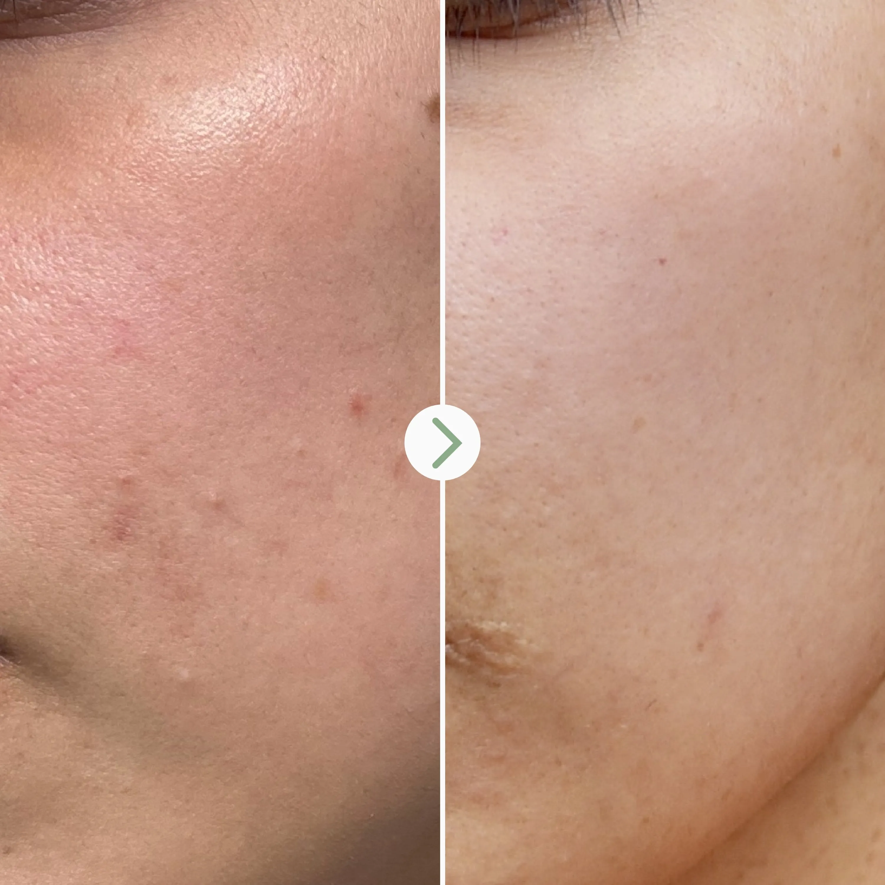 a tinted moisturizer,bubble moisturizer