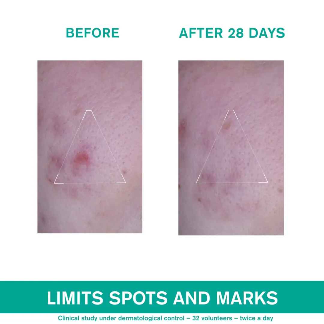 Uriage Hys??ac 3-Regul   Anti-Blemish Global Care 40 ml